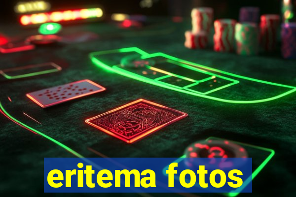 eritema fotos