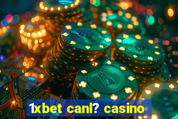 1xbet canl? casino