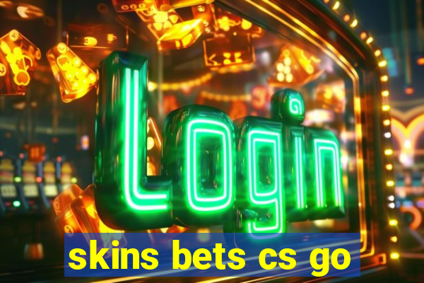 skins bets cs go