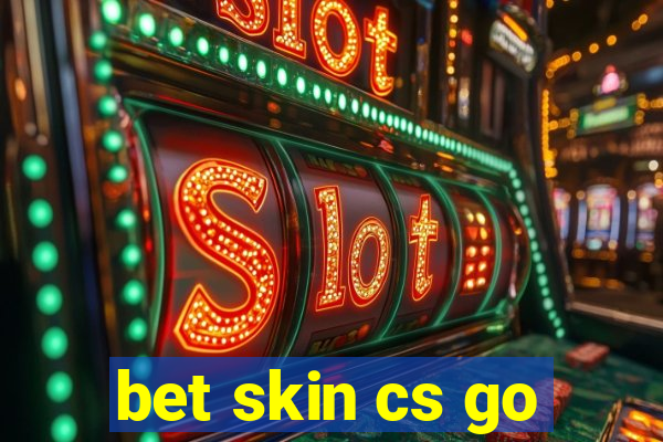 bet skin cs go