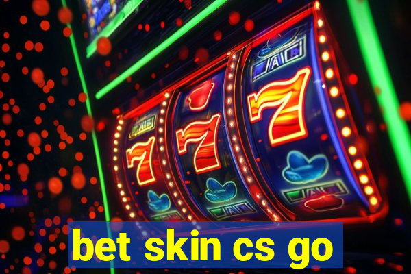 bet skin cs go